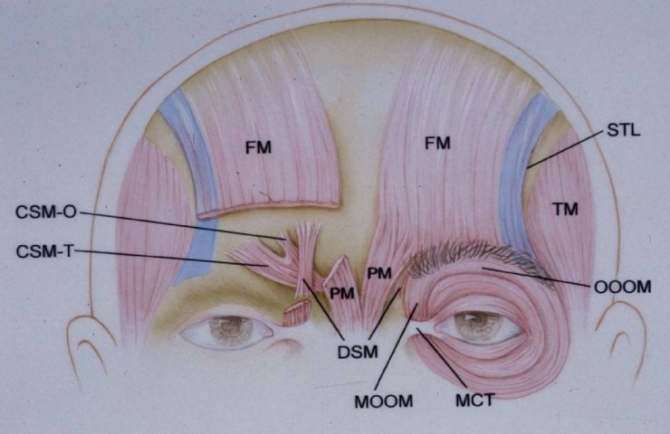 [공유] "이마거상술" 실제 수술은 어떻게 진행되나요? 관련 이미지 3