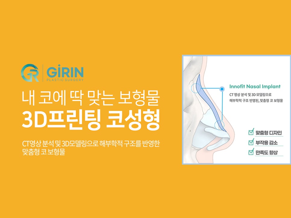 여자코성형후기 얼굴 비율까지 고려하여 관련 이미지 5