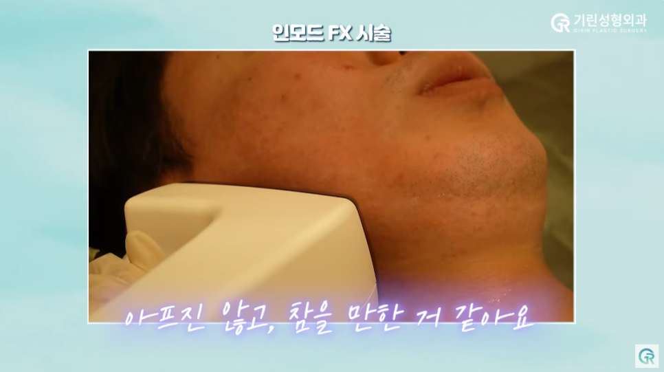 [기린성형외과의원] 수술 없이 턱라인 개선하기_인모드와 지방분해주사 관련 이미지 6