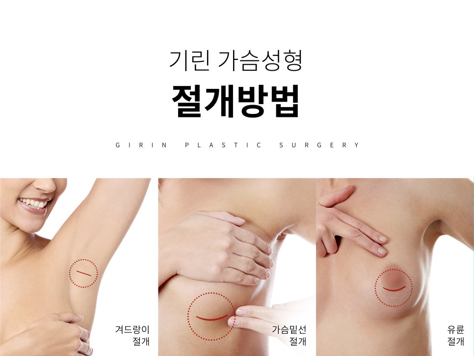 가슴성형잘하는곳 신중하게 보고 관련 이미지 8