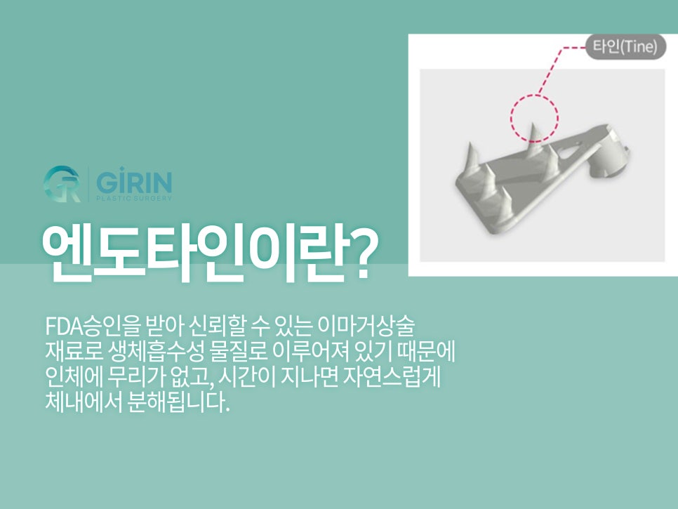 이마거상술효과 확실히 보려면 관련 이미지 7