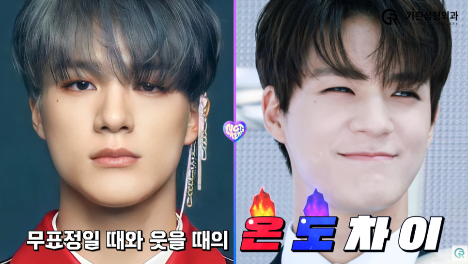 [기린성형외과의원] 얼굴천재 NCT DREAM_성형외과 전문의 얼굴분석 관련 이미지 10