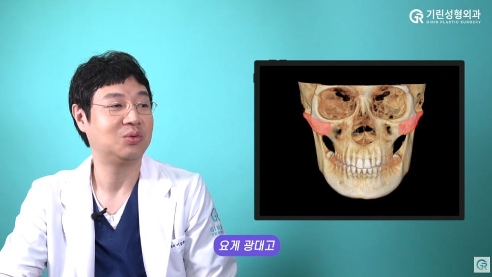 [기린성형외과의원] ❌보정어플은 당장 삭제❌_윤곽3종 수술일지 관련 이미지 7