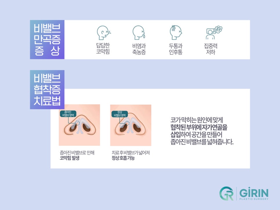 기능성 코성형 원인 찾아 해결하며 관련 이미지 6