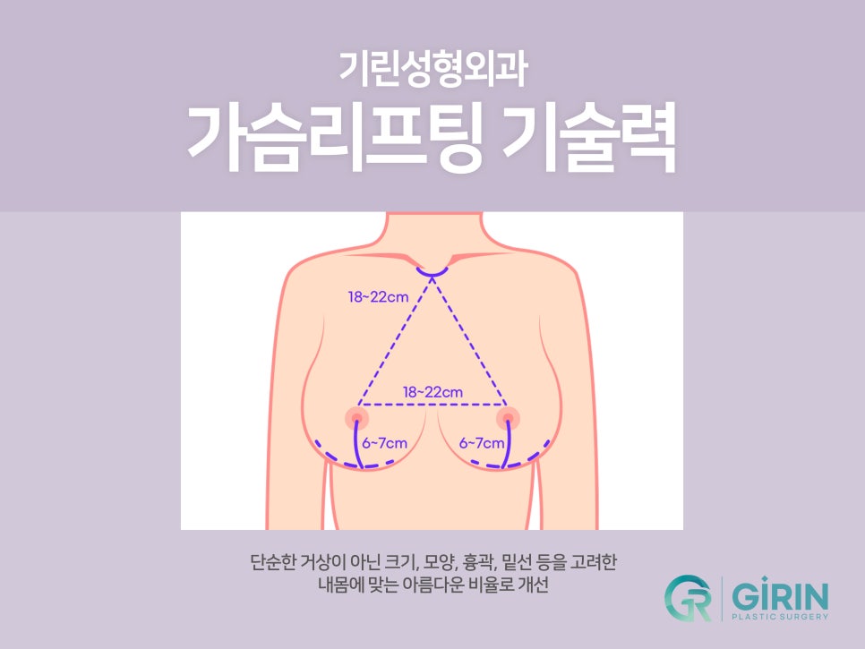 가슴거상술 변화를 기대하며 관련 이미지 3