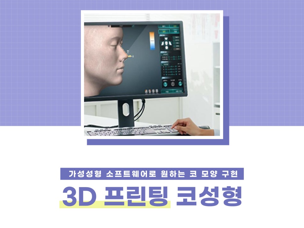 낮은코성형후기 차이점을 고려하여 관련 이미지 9