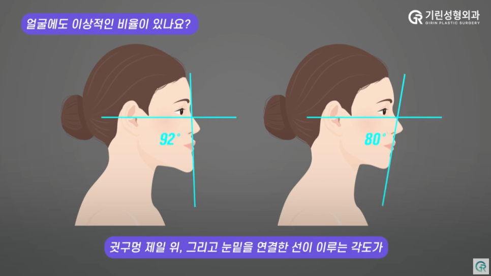 [기린성형외과의원] 얼굴뼈수술 전 필수 시청_초간단 양악수술 자가진단법 관련 이미지 8