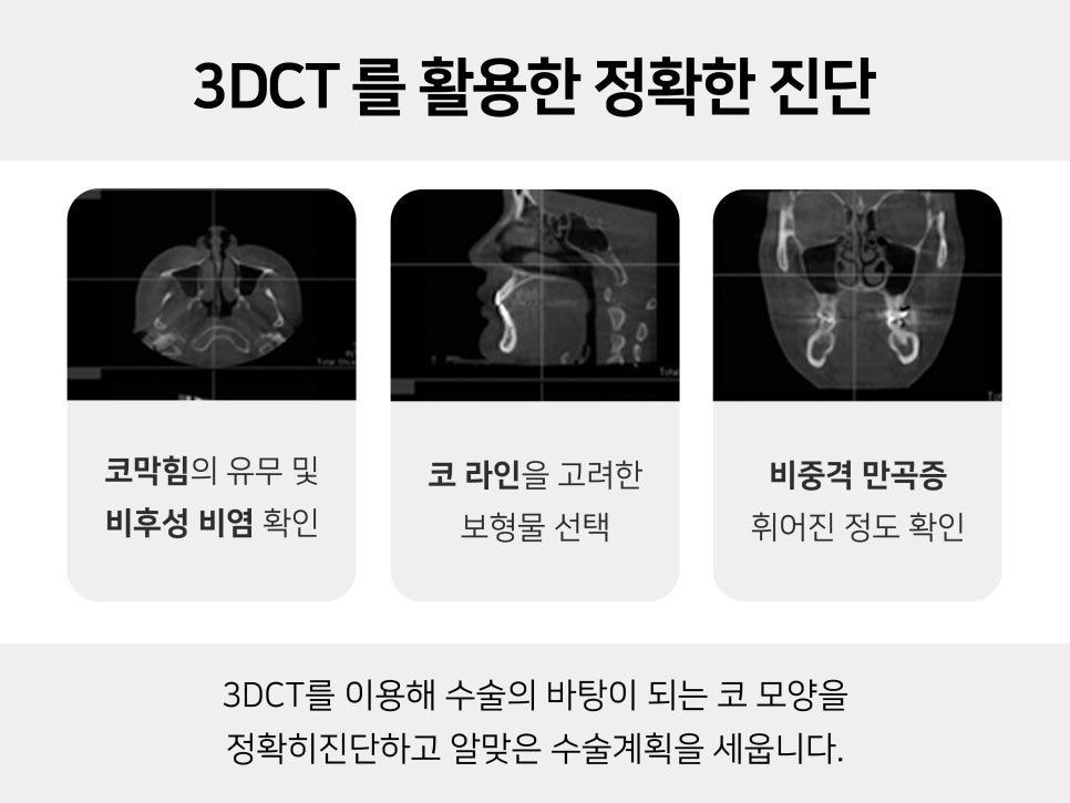 복코수술전후 이미지가 달라지는 관련 이미지 5