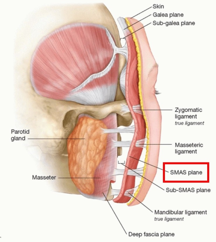[공유] 안면거상술 고민중이시라면 꼭 읽어보세요! 다른 시술이 아닌 안면거상술을 선택해야 하는 해부학적 근거 관련 이미지 6