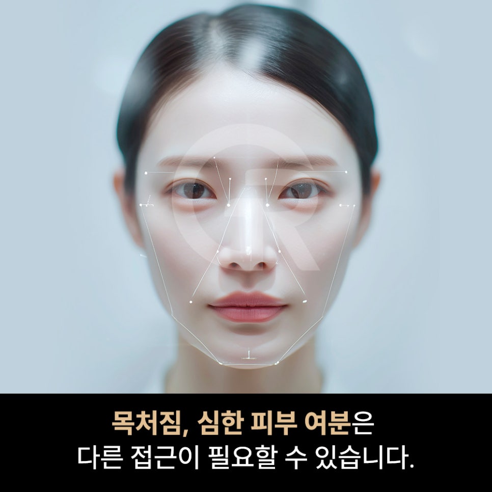 위고비&middot;마운자로 후 얼굴처짐으로 인한 미니거상 후기 관련 이미지 10
