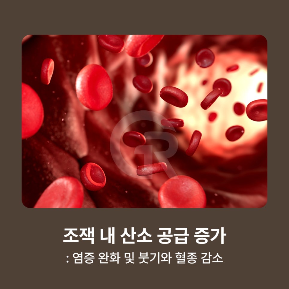 기린성형외과 고압산소치료 최신식 3기압 장비의 차별점 관련 이미지 7