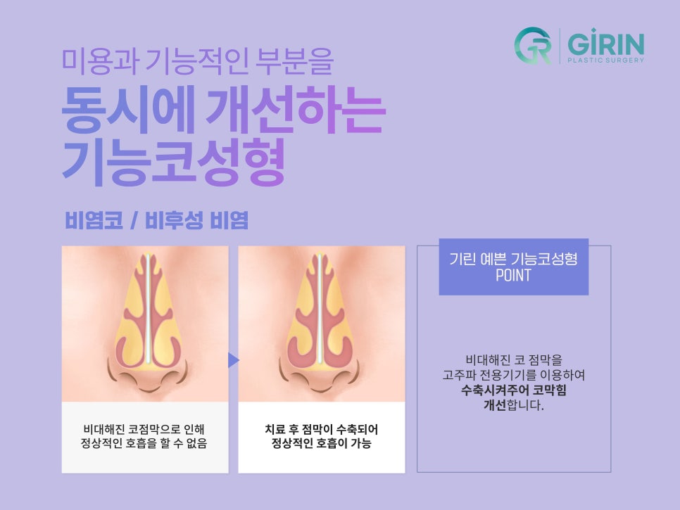 강남코수술잘하는곳 궁금했다면 관련 이미지 6