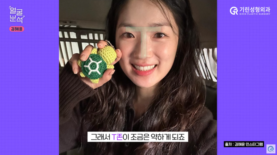 [기린성형외과의원] 선재 업고 튄 임솔 비주얼_선업튀 2탄 김혜윤 얼굴분석 관련 이미지 5