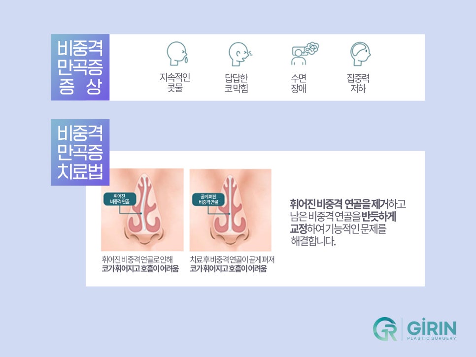 기능성 코성형 원인 찾아 해결하며 관련 이미지 5