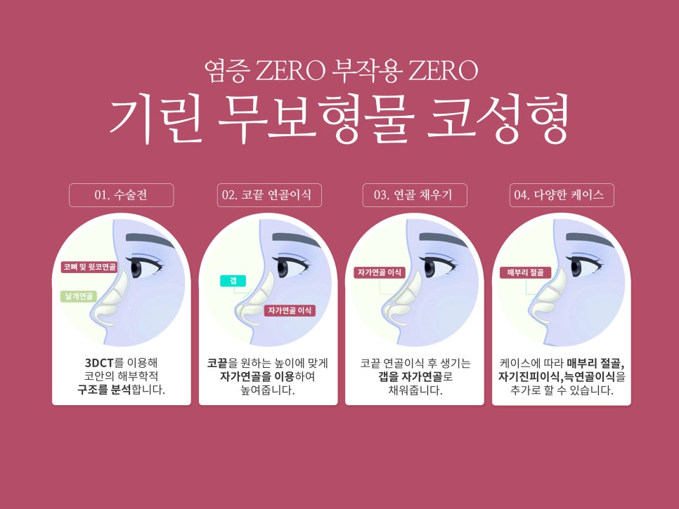 강남코성형 차이점이 있어야 관련 이미지 11