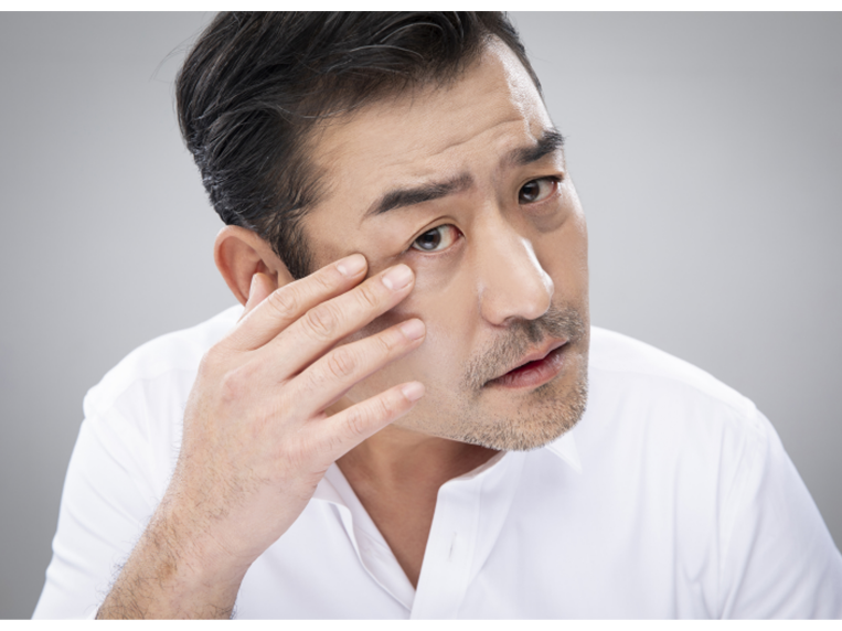 상하안검수술 인상을 바꾸기 위해 관련 이미지 11