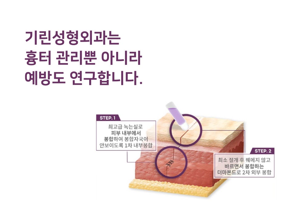 논현역 성형외과 안심할 수 있는 가슴확대수술 관련 이미지 8