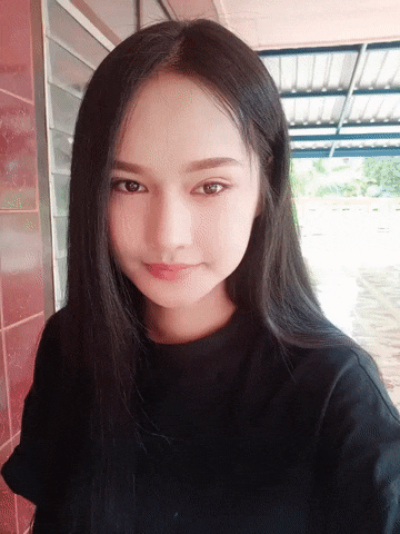 [사각턱축소 최다수술 이승룡원장] 태국에서 온 그녀의 윤곽 수술 후기 리얼 스토리&hearts; 관련 이미지 8