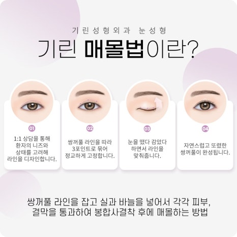 쌍수가격? 의미 없는 이유 관련 이미지 6