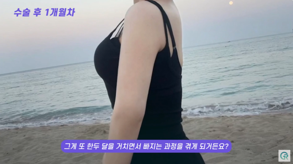 [기린성형외과] 뼈 팔뚝 된 비결 알려줄게_팔뚝 지방흡입 수술일지 관련 이미지 11