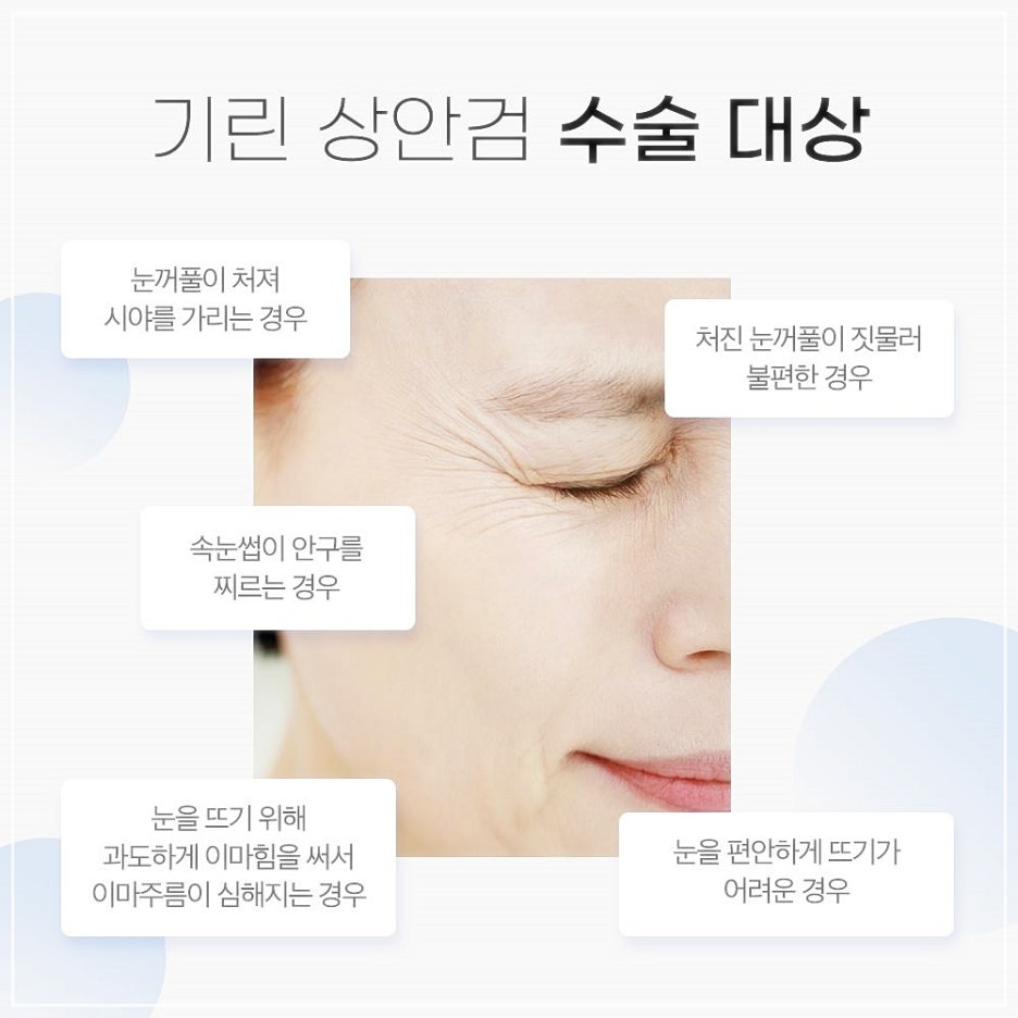 비절개상안검수술 처진중년눈성형 이젠 고민만 하지말자! 관련 이미지 4