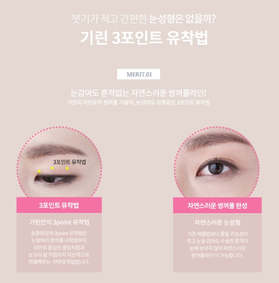 요즘 누가 티나게 성형하니? 기린성형외과 자연유착으로 미모완성♥(+후기) 관련 이미지 4