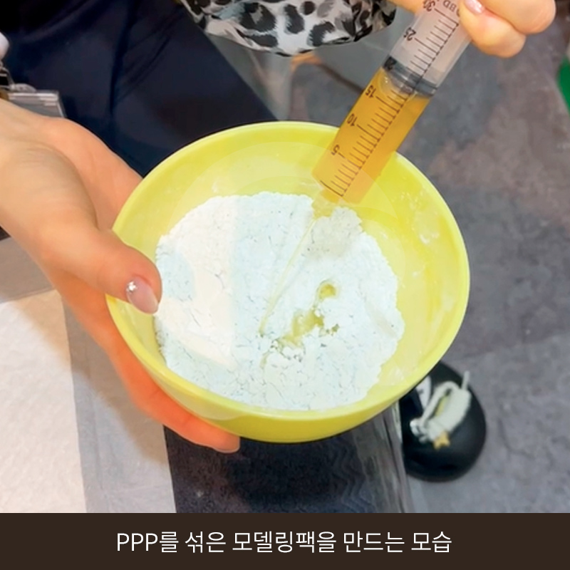 탈모 고민 두피 줄기세포 치료, 가격이 다른 이유는? 관련 이미지 14