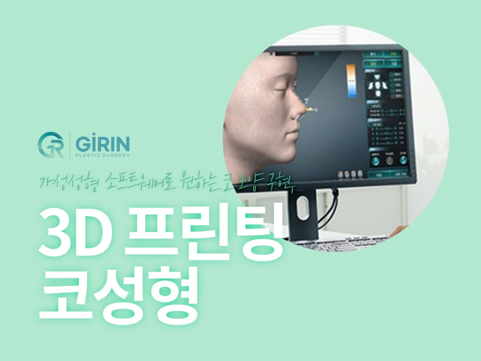 코성형 종류 비교하고 맞춰서 관련 이미지 3