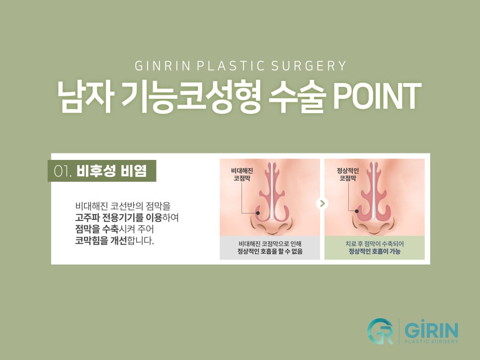 남자코성형잘하는곳 자연스러운 모습은 관련 이미지 6