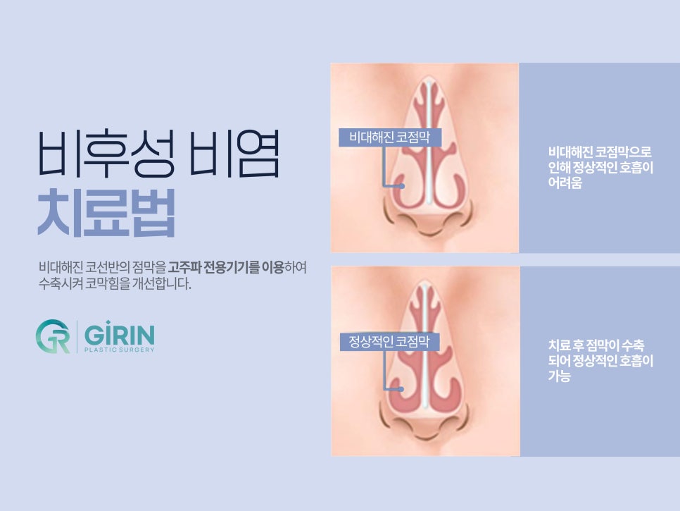 강남성형외과순위 선택은 신중하게 관련 이미지 7