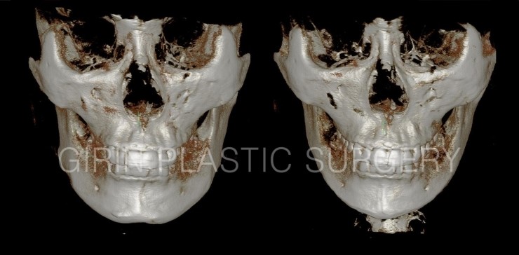 뉴브이라인 6주차 관련 이미지 2