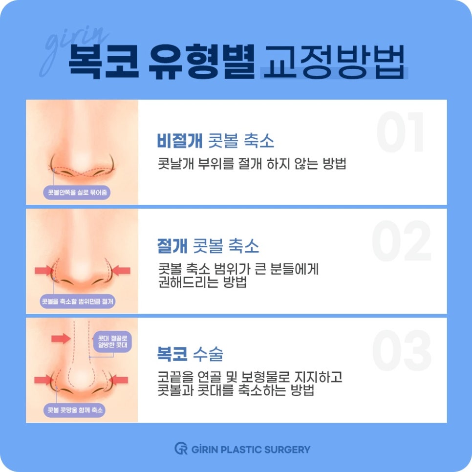 코성형잘하는곳? 강남 기린성형외과를 찾는 이유는 OOO이다 관련 이미지 8