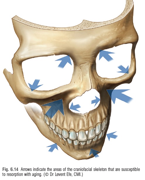 [공유] 안면거상술 고민중이시라면 꼭 읽어보세요! 안면거상술 어떤 분들에게 필요하고, 어떤 효과가 있는 수술인가? 관련 이미지 6