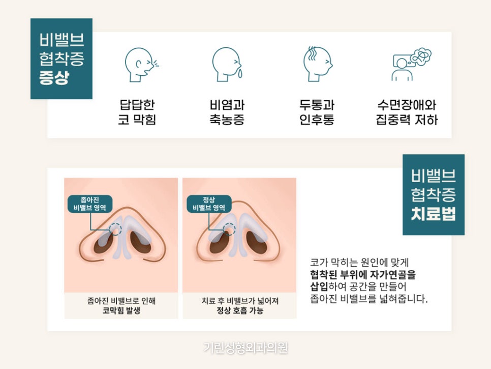 비중격만곡증코성형 같이 진행하고 싶으면 관련 이미지 8