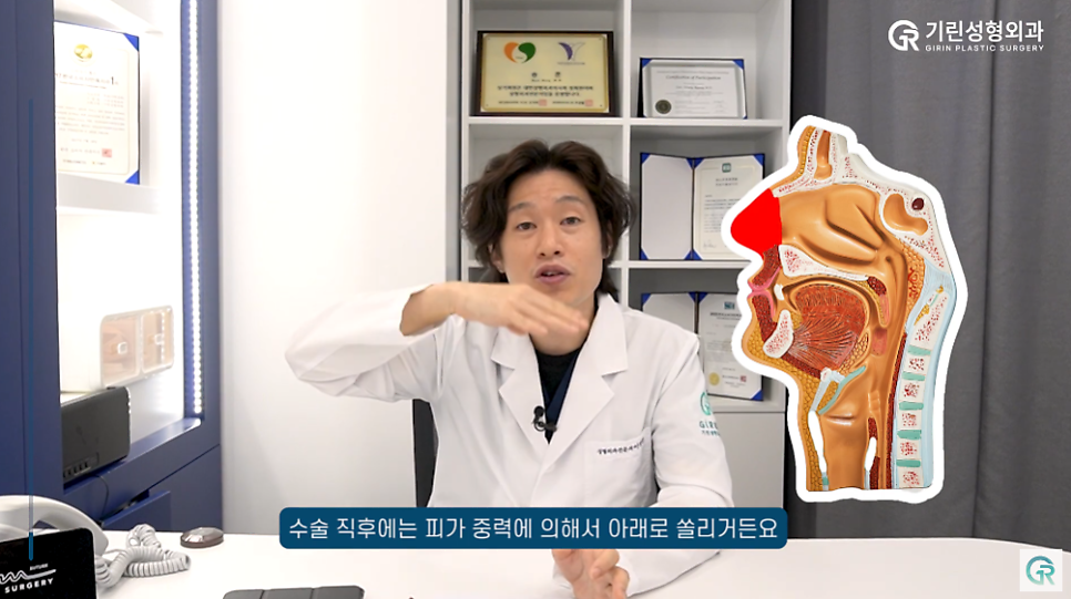 [기린성형외과] "딱 한 개비도 안될까요...?"_코성형 주의사항 Q&A 관련 이미지 3
