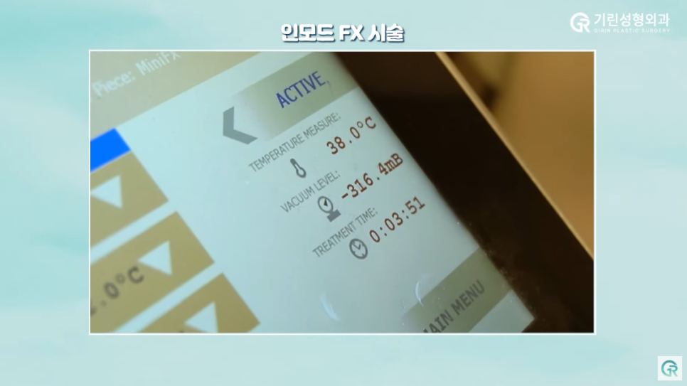 [기린성형외과의원] 수술 없이 턱라인 개선하기_인모드와 지방분해주사 관련 이미지 5