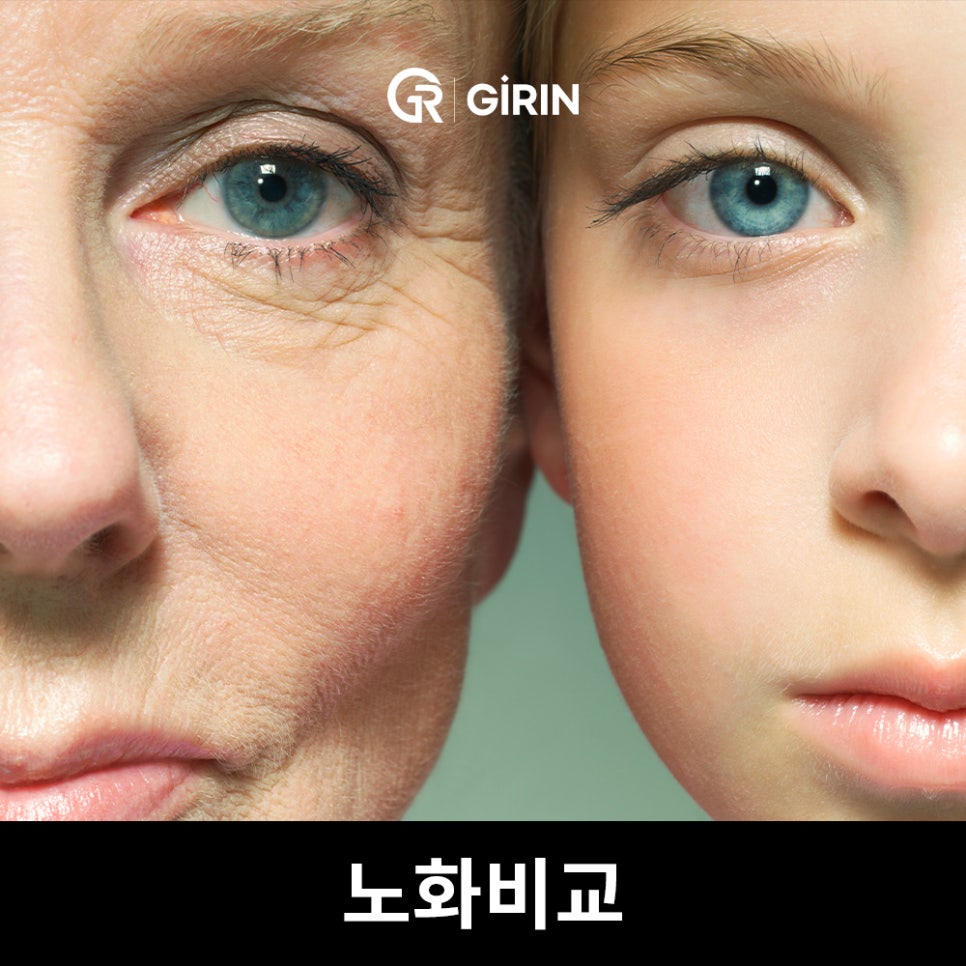 안면거상 비용, 왜 이렇게 차이 날까? 관련 이미지 1