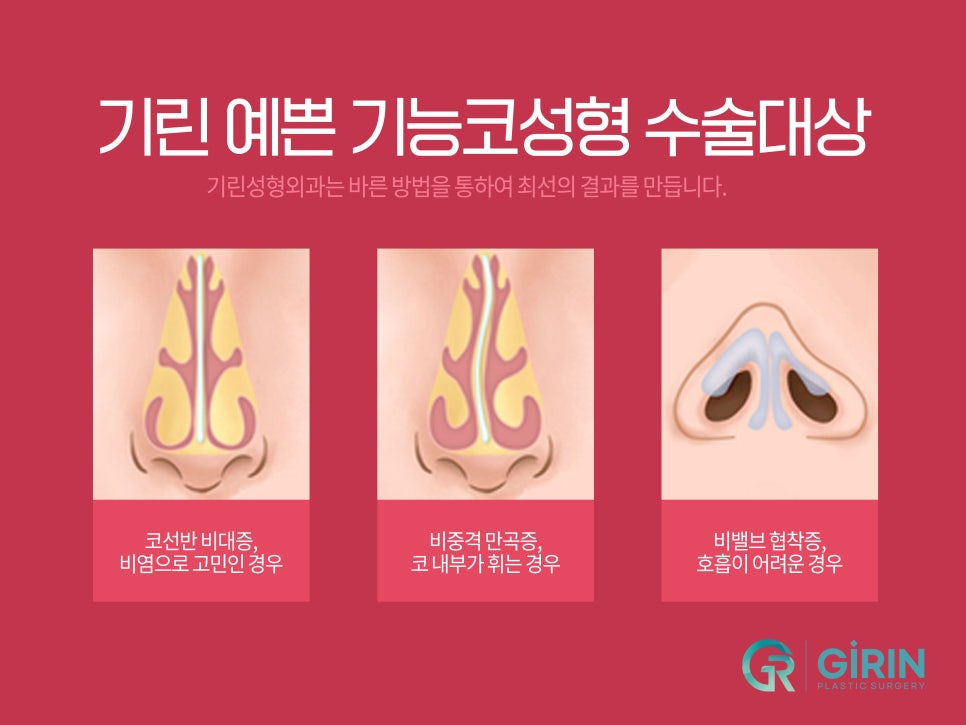 강남코성형 차이점이 있어야 관련 이미지 3