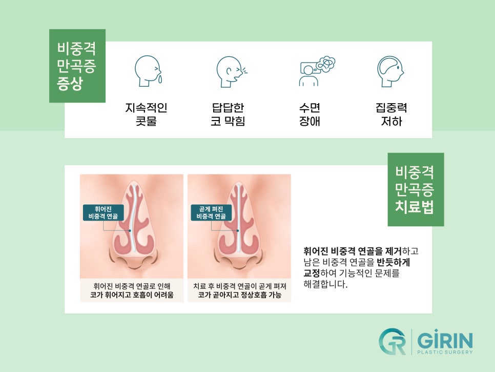 비염코성형 실비 가능성 있기에 관련 이미지 6