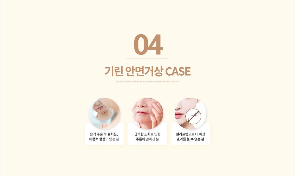 안면거상술효과 만족스러울려면? 관련 이미지 6