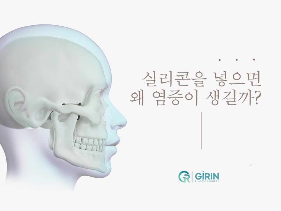 무보형물 코성형 안전하게 잘하는 곳 관련 이미지 2