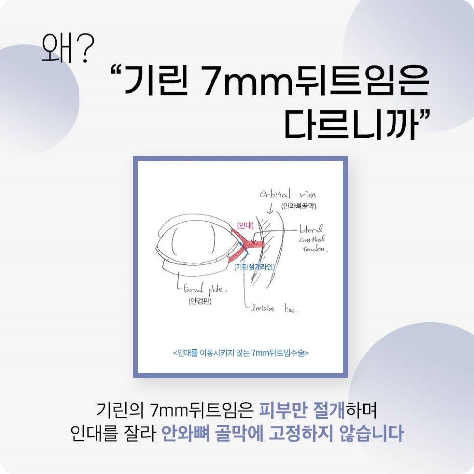 쌍수가격? 의미 없는 이유 관련 이미지 9