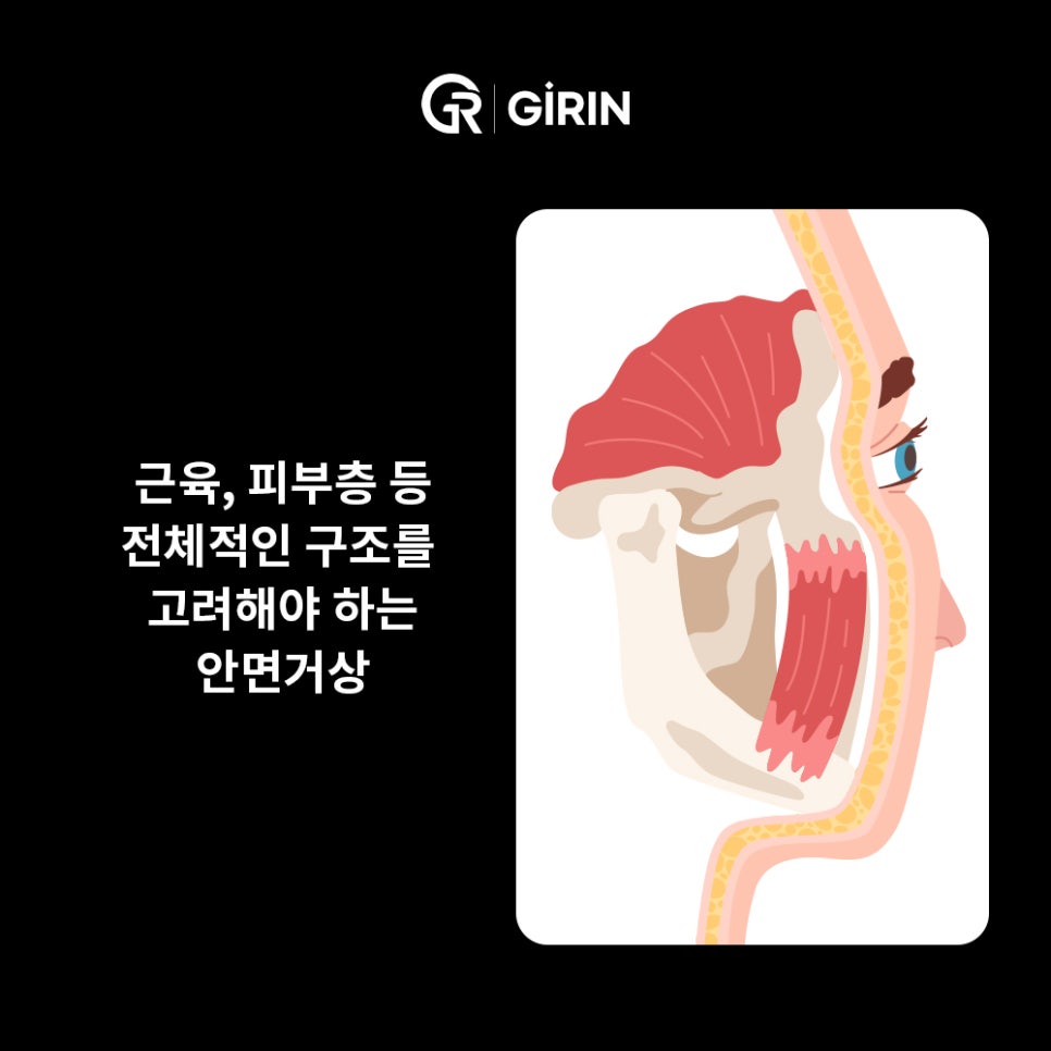 안면거상 비용, 왜 이렇게 차이 날까? 관련 이미지 6