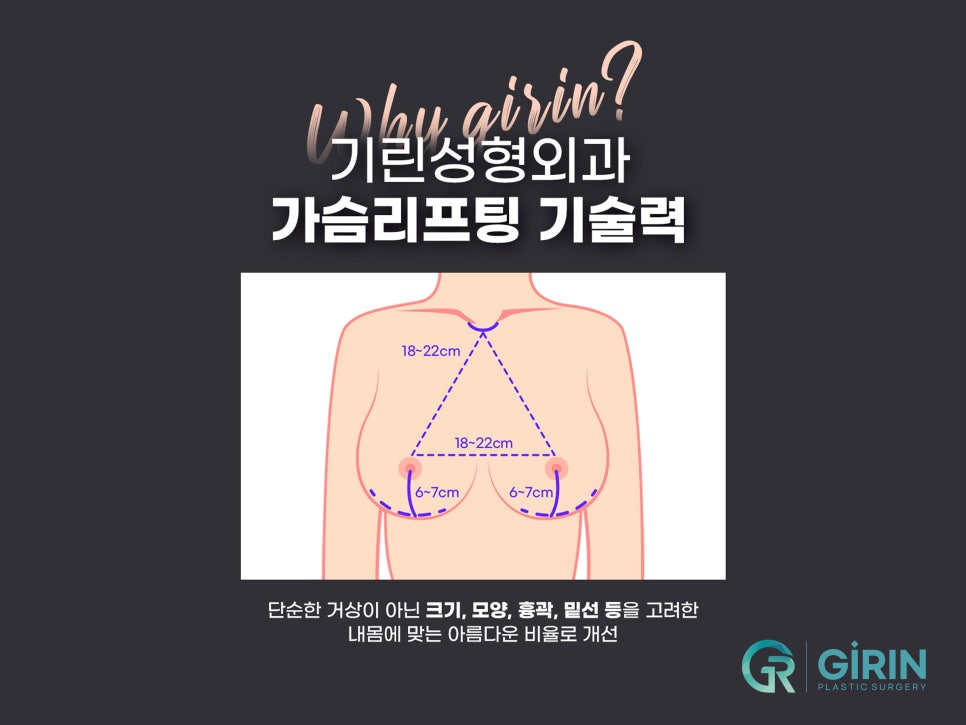 가슴처짐수술 교정으로 자신감 찾아 관련 이미지 4