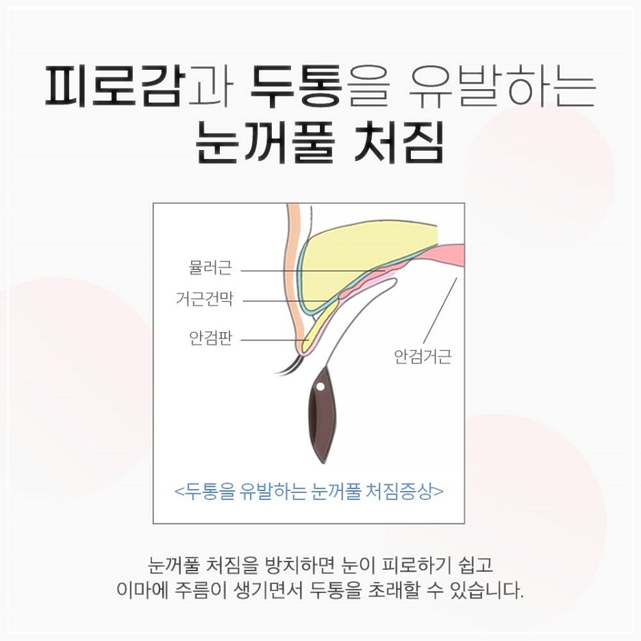 안검하수수술 눈꺼풀처짐 개선이 먼저입니다! 관련 이미지 3