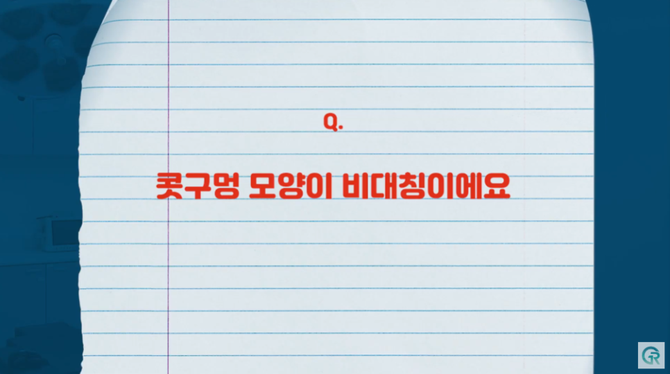[기린성형외과] "딱 한 개비도 안될까요...?"_코성형 주의사항 Q&A 관련 이미지 6