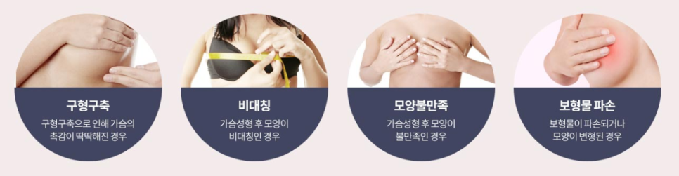 가슴재수술? 관련 이미지 2