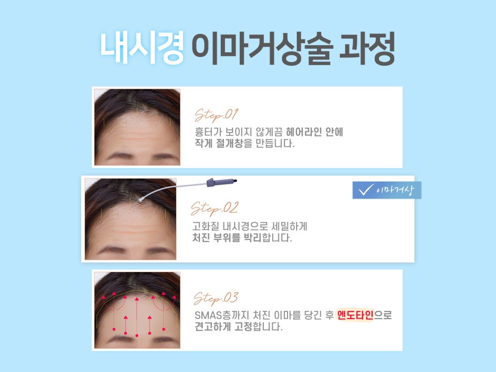 이마거상술 미리 확인해야 할 부분은? 관련 이미지 6