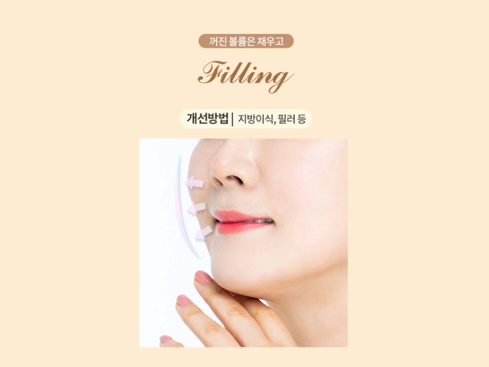 안면거상수술 효과 확실하려면 관련 이미지 6