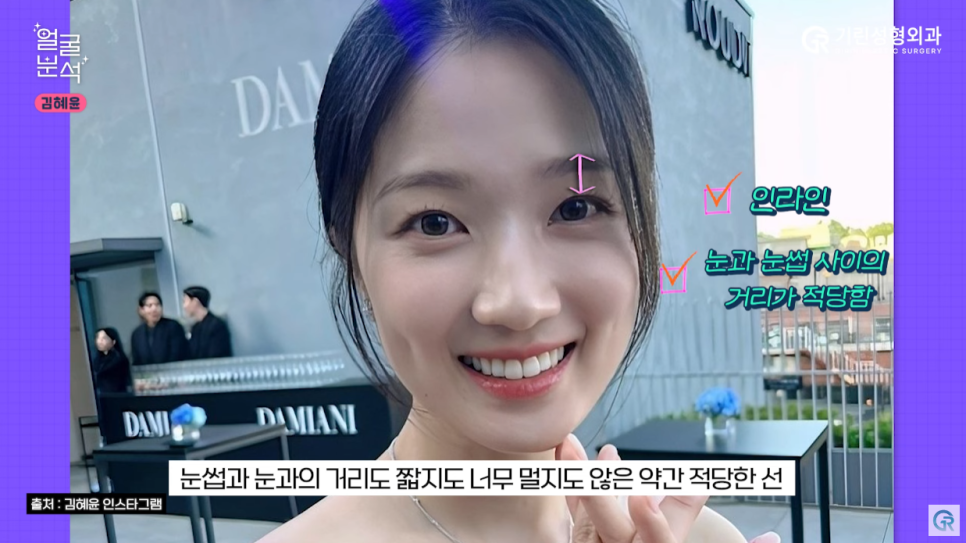 [기린성형외과의원] 선재 업고 튄 임솔 비주얼_선업튀 2탄 김혜윤 얼굴분석 관련 이미지 2
